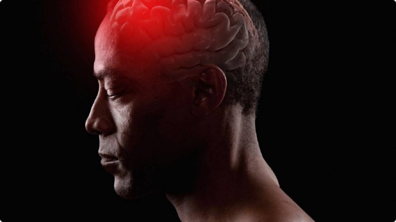 انواع آنوريسم مغزى