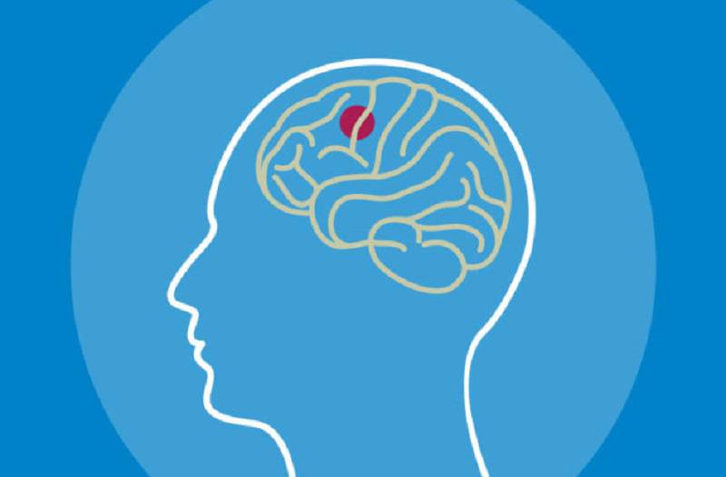 انواع تومور مغزی