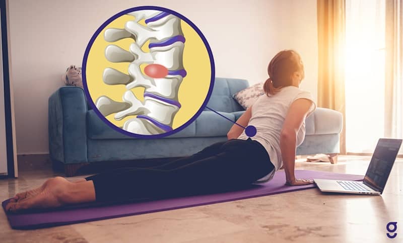 ایا حرکت ورزشی دیسک کمر موثر است؟